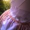 Burdaid_thumb