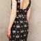 Staticwriggledress3_grid