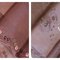 Lace_collage_grid